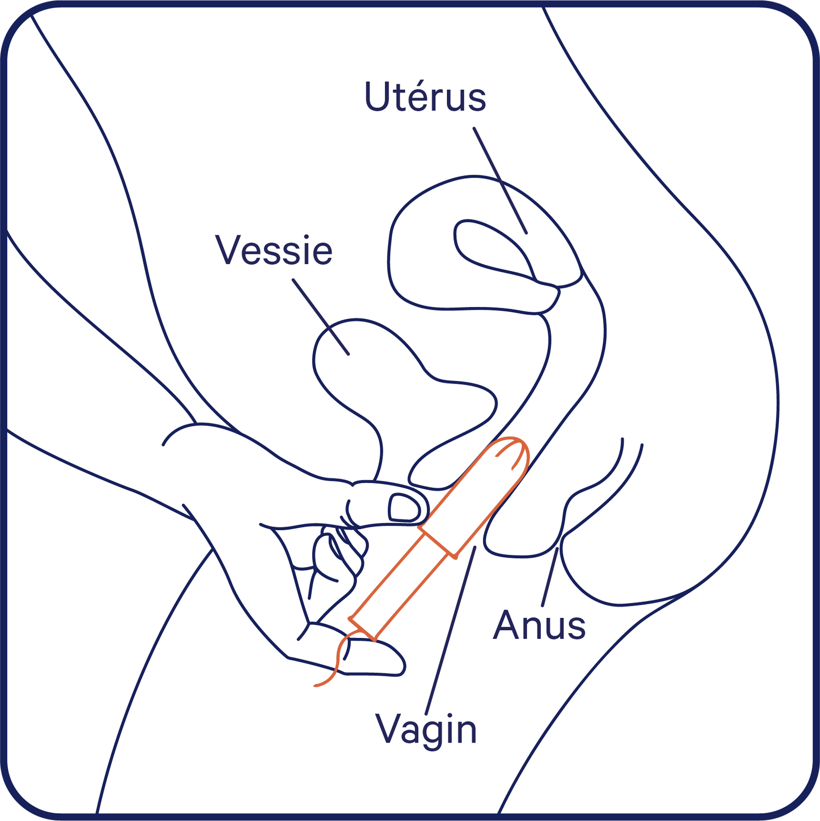 schéma en français expliquant comment insérer un tampon avec applicateur