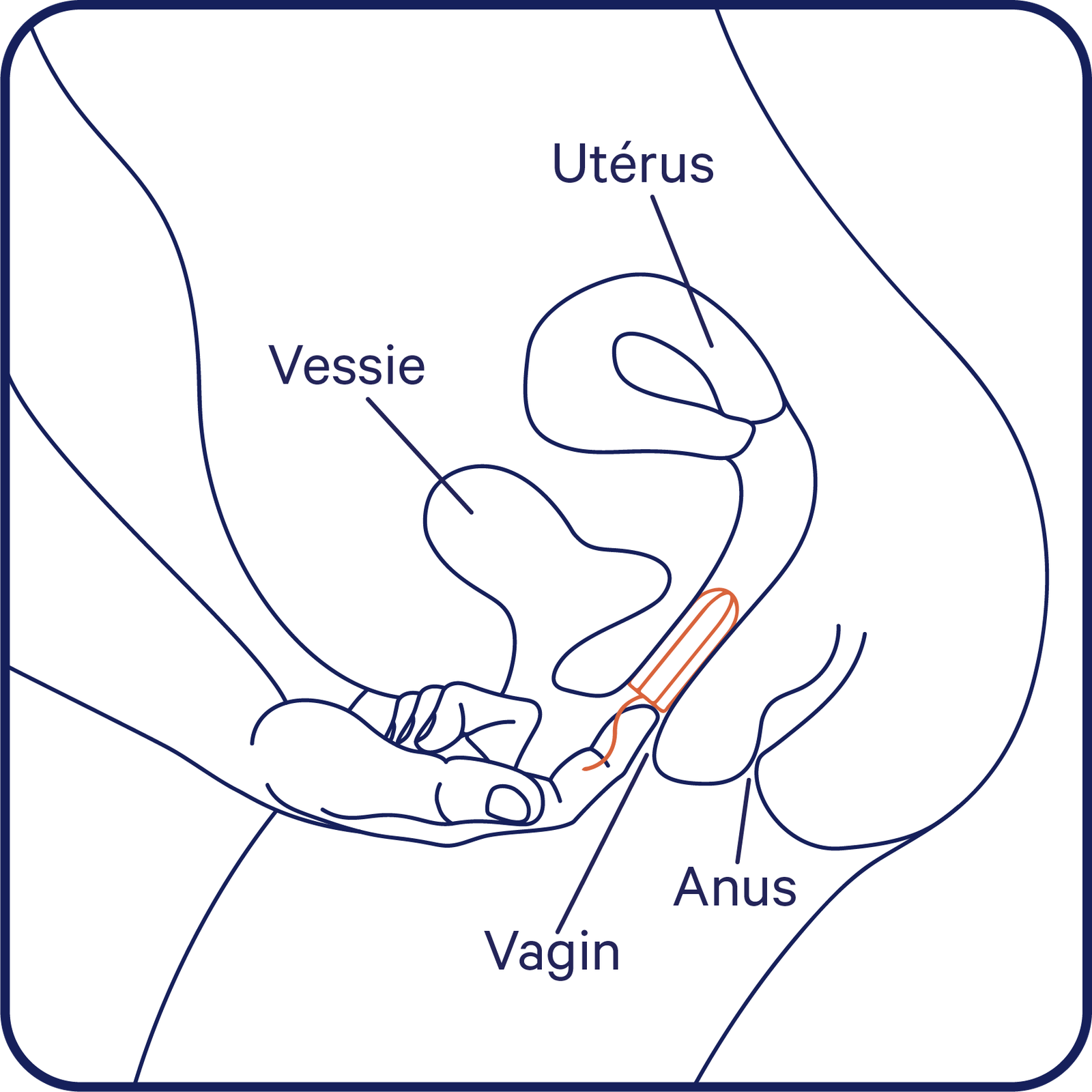 schéma en français expliquant comment insérer un tampon périodique