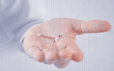 Stérilet et règles : quel impact sur le corps ?